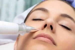 Best Actinic Keratoses Removal 3 Actinic keratoses Stowmarket solutions - book in today!